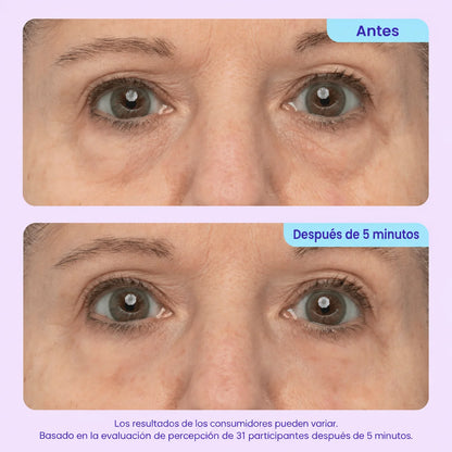 ¡DILE ADIOS A ESAS BOLSAS QUE ARUINAN TU ROSTRO! - TRATAMIENTO PROFESIONAL EFECTO LIFTHING - 60%OFF