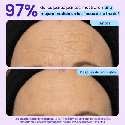 ¡DILE ADIOS A ESAS BOLSAS QUE ARUINAN TU ROSTRO! - TRATAMIENTO PROFESIONAL EFECTO LIFTHING - 60%OFF
