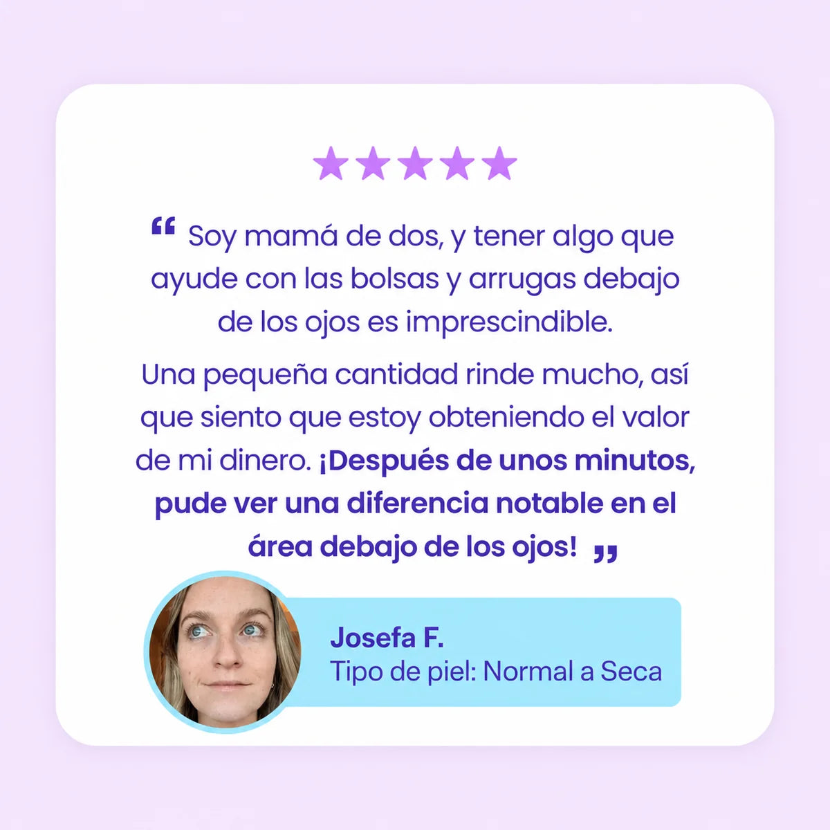 ¡DILE ADIOS A ESAS BOLSAS QUE ARUINAN TU ROSTRO! - TRATAMIENTO PROFESIONAL EFECTO LIFTHING - 60%OFF
